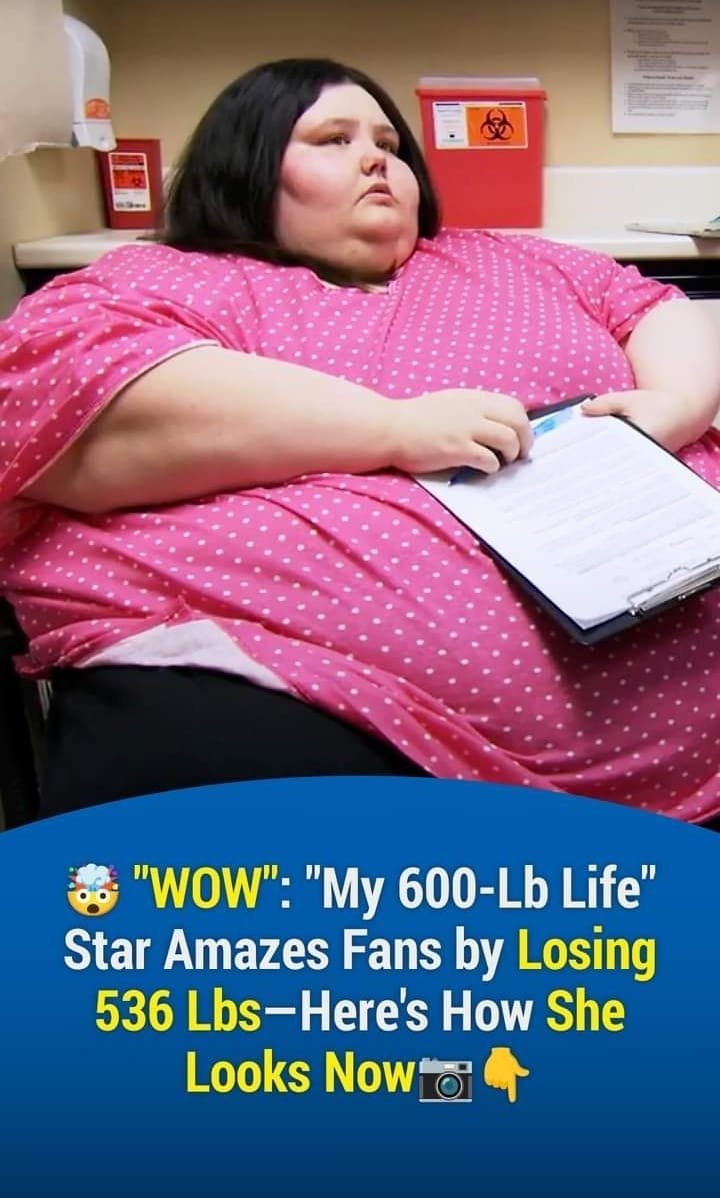 People Stunned After ‘World’s Heaviest Woman’ Loses 500+ lbs – Here’s What She Looks Like Now