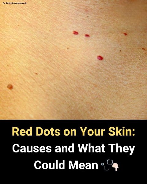 11 Causes of Red Dots Appearing on Your Skin